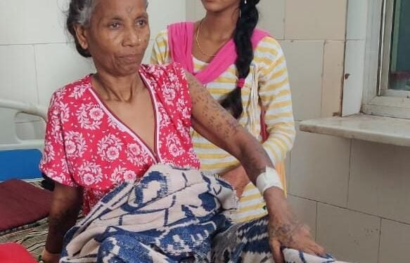 उपमुख्य विजय शर्मा के प्रयासों से बुजुर्ग महिला को मिला जीवनदान, महिला बच्चेदानी से 12 किलोग्राम का मल्टीपल ओवेरियन सिस्ट (गांठ) का हुआ सफल ऑपरेशन 1 उपमुख्य विजय शर्मा के प्रयासों से बुजुर्ग महिला को मिला जीवनदान, महिला बच्चेदानी से 12 किलोग्राम का मल्टीपल ओवेरियन सिस्ट (गांठ) का हुआ सफल ऑपरेशन