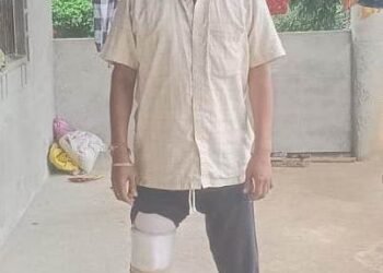 रायपुर : मुख्यमंत्री  साय की पहल पर सड़क दुर्घटना में एक पैर गंवा चुके नंदकुमार को मिला कृत्रिम पैर