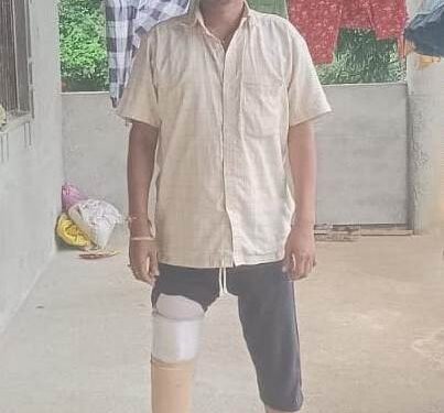 रायपुर : मुख्यमंत्री  साय की पहल पर सड़क दुर्घटना में एक पैर गंवा चुके नंदकुमार को मिला कृत्रिम पैर